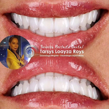 Slider image (3) Sonrisa Perfecta Dental